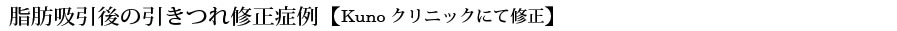 脂肪吸引後の引きつれ修正症例【Kunoクリニックにて修正】